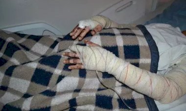 Homem ateia fogo na namorada e tranca a porta da residência em Água Clara